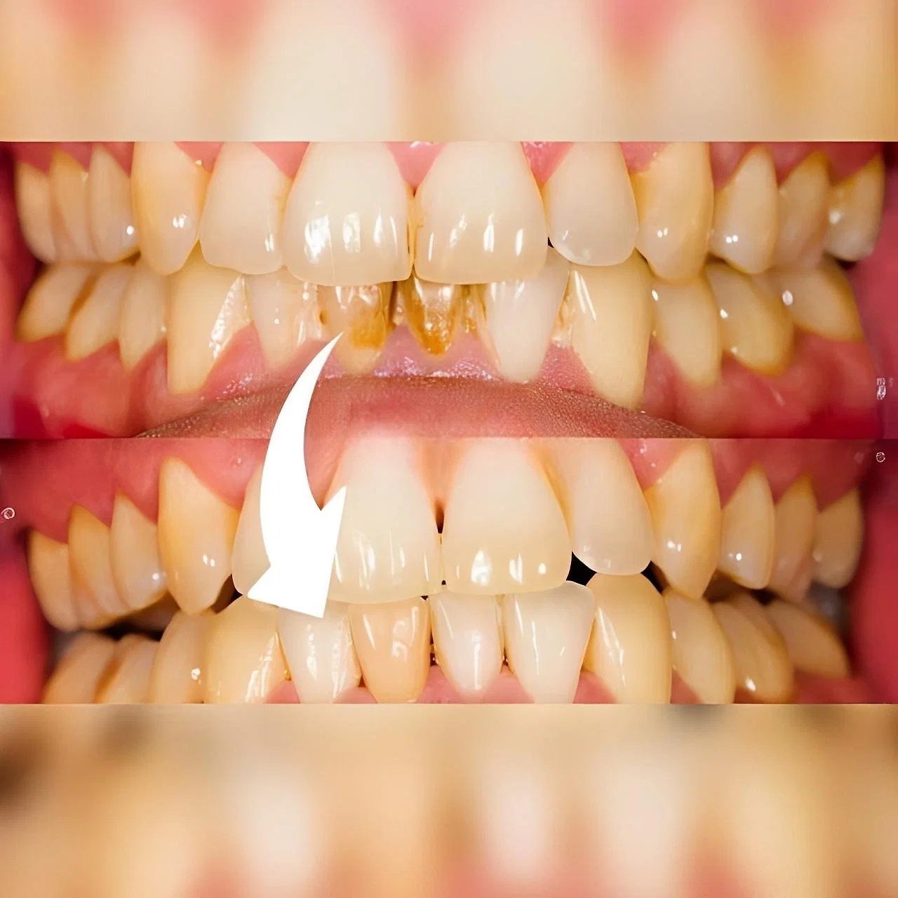 professional-dental-scaler-41191001_3.jpg